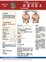 Cholecystectomy | Chinese Instructions | University Bariatrics